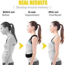 The Posture Corrector — Daily Frame Reset