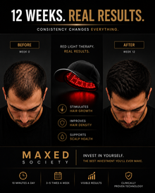 Portable Red Light Hair Growth Cap
