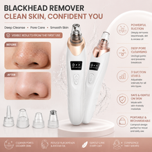 Pore Vacuum — Electric Blackhead Cleaner
